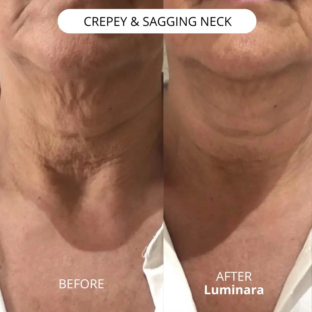 Lifting Neck Cream